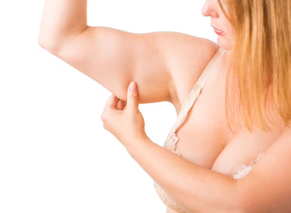 a photo of an overweight woman looking at her arm