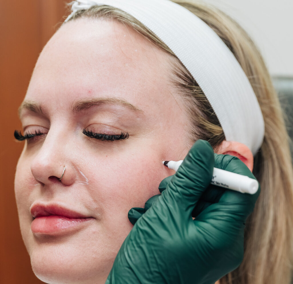 A patient wearing a headband shuts her eyes and smiles while a provider prepares Juvederm near Kalamazoo.